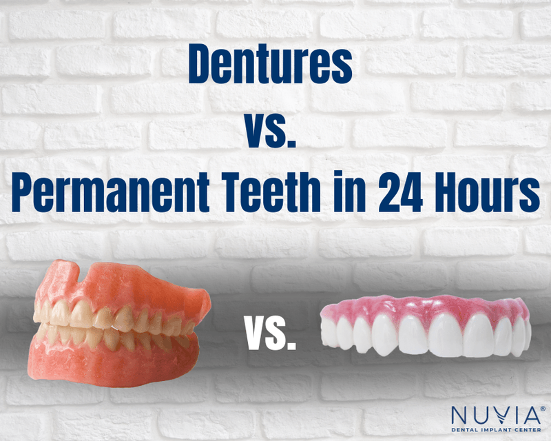 Dentures vs. Permanent Teeth in 24 Hours